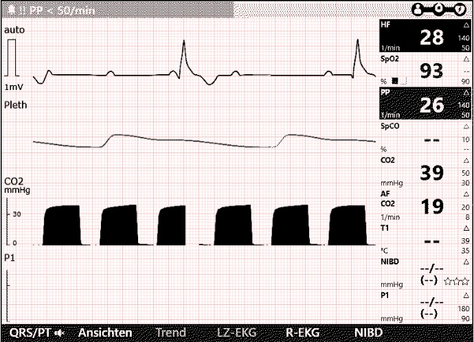 C3 Screenshot