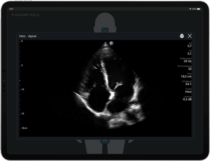 POCUS Simulation am iPad