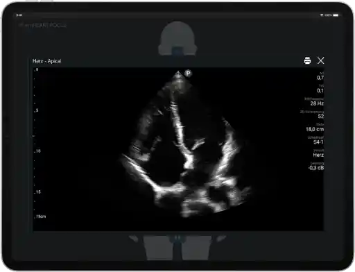 Point-of-Care Ultraschall